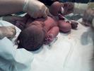Baby10