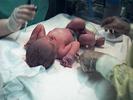 Baby11